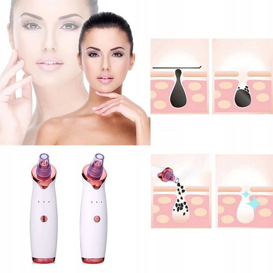 112 : ODKURZACZ DO WĄGRÓW/ DIAMOND MICRODERMABRASION