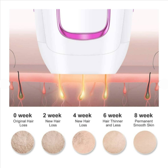 7012 : Depilator laserowy / IPL hair removal