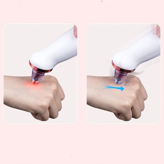 112 : ODKURZACZ DO WĄGRÓW/ DIAMOND MICRODERMABRASION