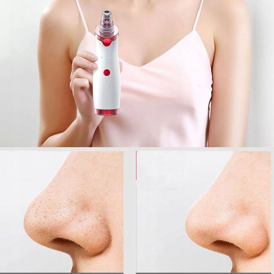 112 : ODKURZACZ DO WĄGRÓW/ DIAMOND MICRODERMABRASION