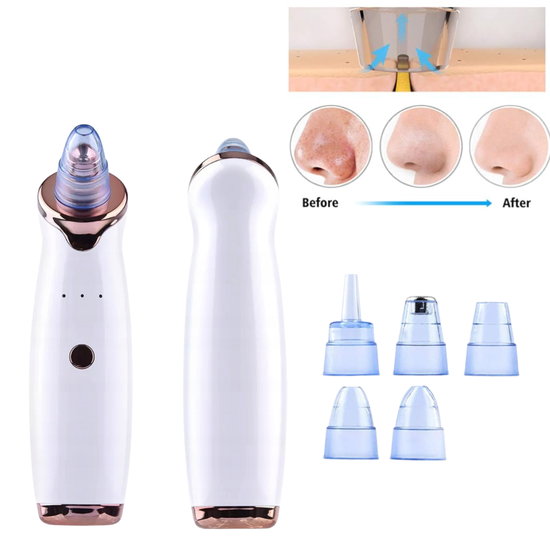 ODKURZACZ DO WĄGRÓW/ DIAMOND MICRODERMABRASION